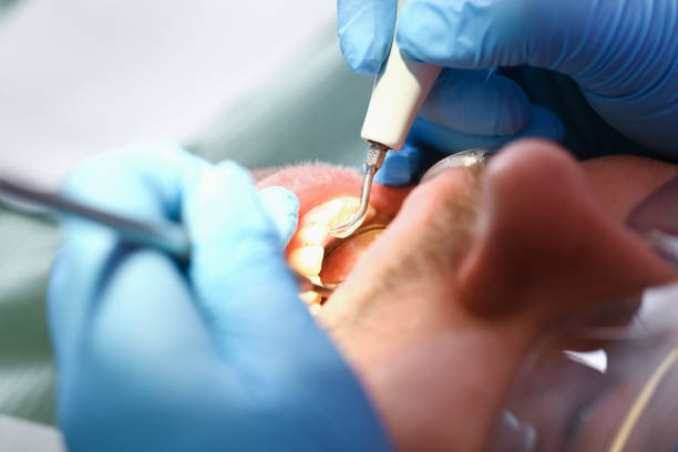 Best Emergency Orthodontic Repairs in Friday Harbor, WA
